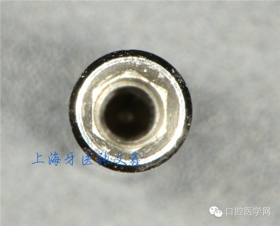 種植替代體上的細節不可忽視