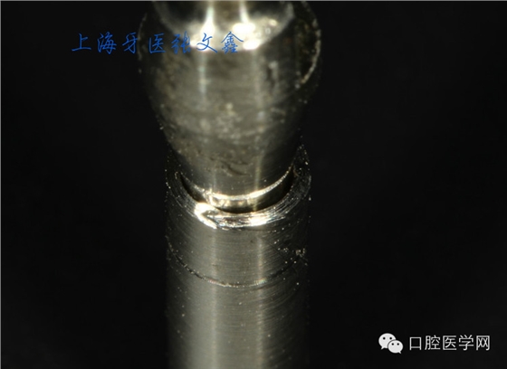 種植替代體上的細節不可忽視