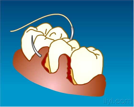 QQ圖片20150729104757.png QQ圖片20150729104757.png