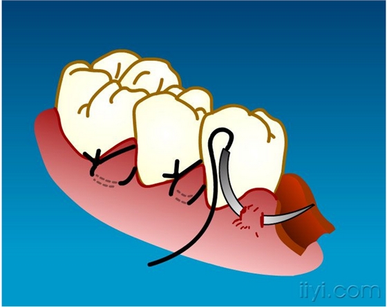 QQ圖片20150729104854.png QQ圖片20150729104854.png
