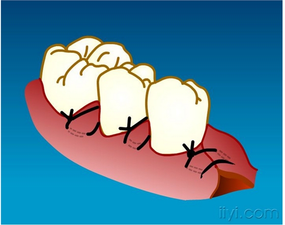 QQ圖片20150729104930.png QQ圖片20150729104930.png
