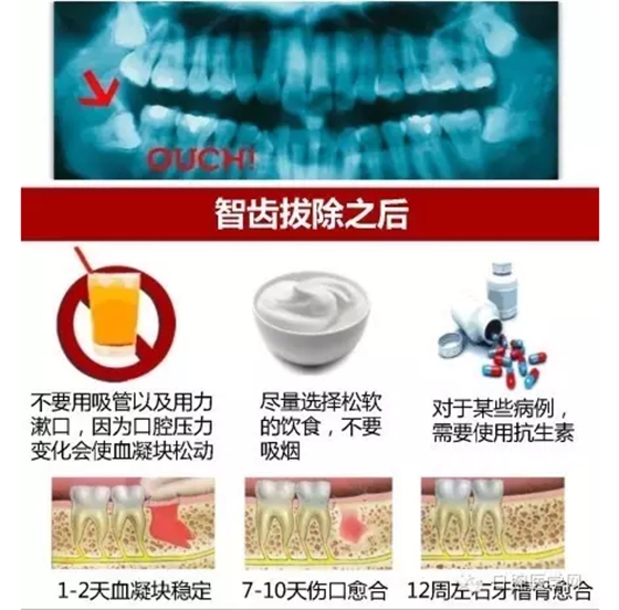 QQ圖片20150824114655.png QQ圖片20150824114655.png