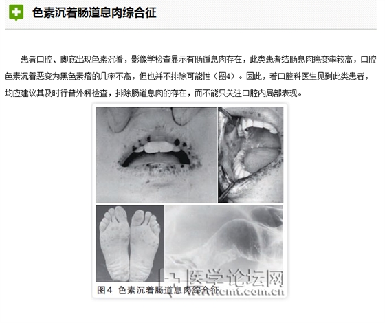 口腔疾病與全身系統性疾病的關系