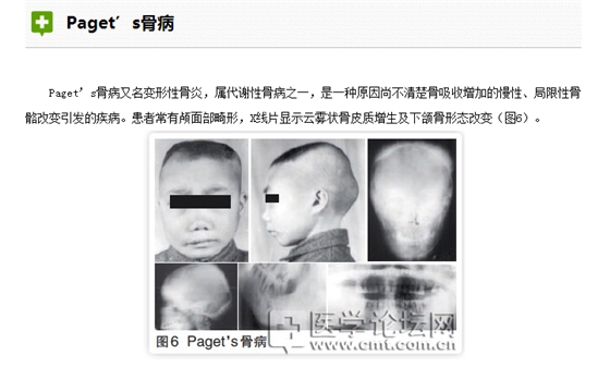 口腔疾病與全身系統性疾病的關系