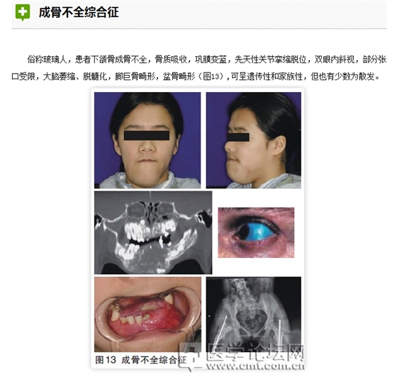 口腔疾病與全身系統性疾病的關系