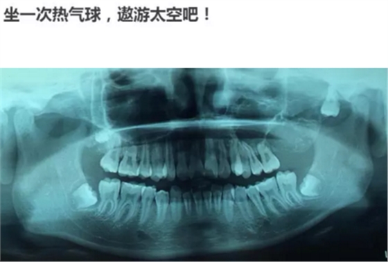 2.png 2.png