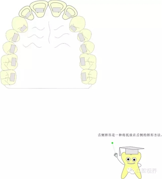 【愛(ài)牙科普知識(shí)300問(wèn)】 “什么是頜（牙）墊？”