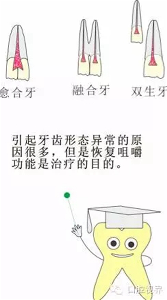 【愛牙科普知識300問】 “什么是融合牙、愈合牙和雙生牙？”