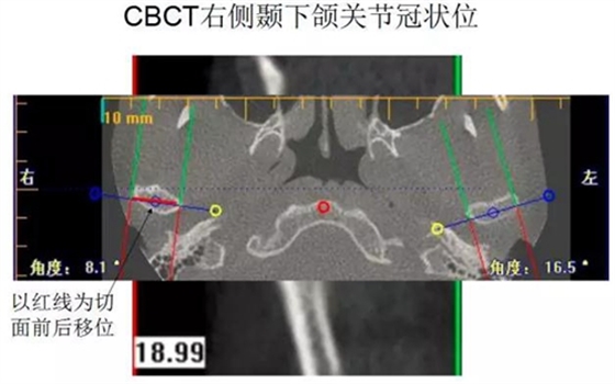 	口腔修復治療中，常見臨床接診流程