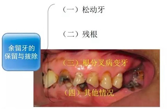 	口腔修復治療中，常見臨床接診流程