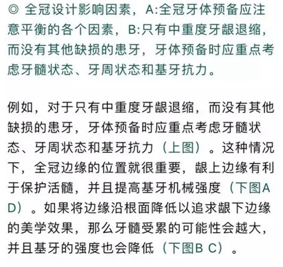 做全冠修復(fù)時基牙根面暴露，如何備牙？