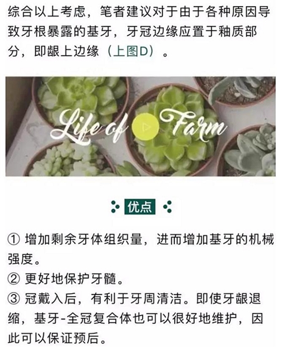 做全冠修復(fù)時基牙根面暴露，如何備牙？