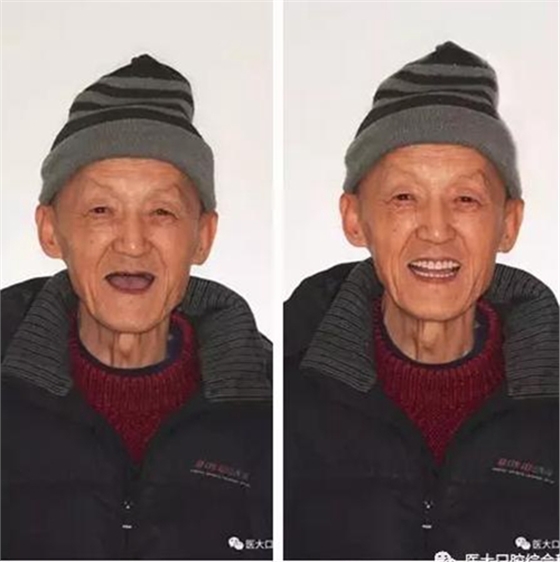 醫大口腔綜合科 |“鑲牙”的學問——活動類 
