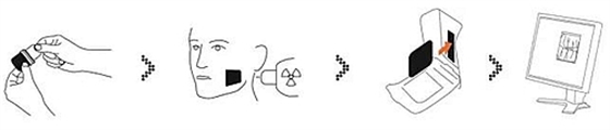 數字口內影像板掃描處理系統-牙片寶 