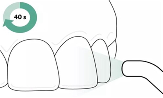 Icon 愛(ài)康滲透樹(shù)脂使用說(shuō)明書