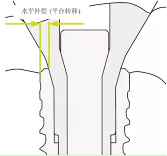 揭秘士卓曼種植體-基臺的長期穩定性