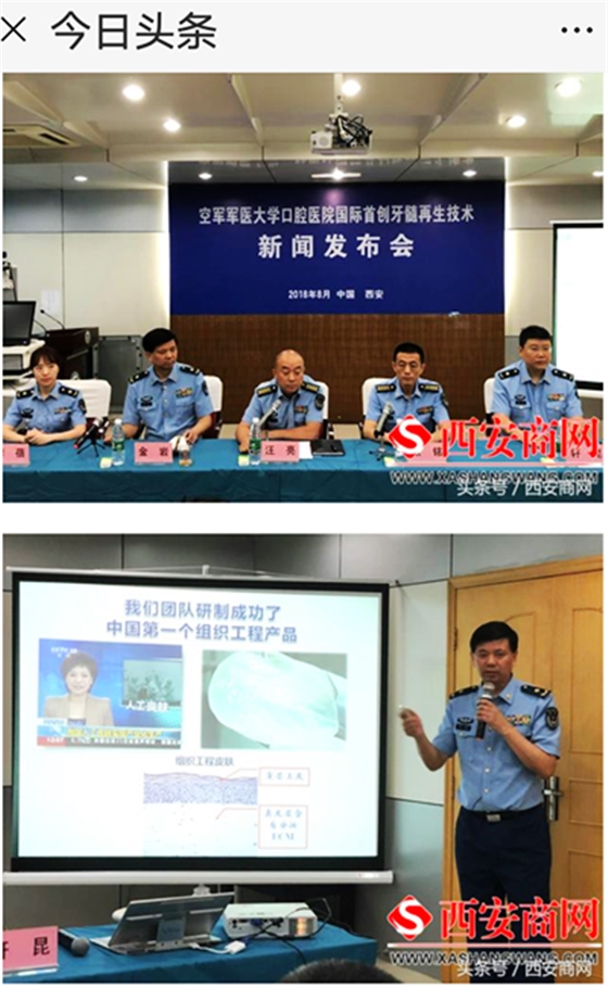 空軍軍醫大學口腔醫院首創牙髓再生術