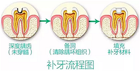 你總嚷著看牙“貴”還不是你自己造成的