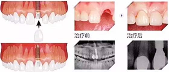 你總嚷著看牙“貴”還不是你自己造成的
