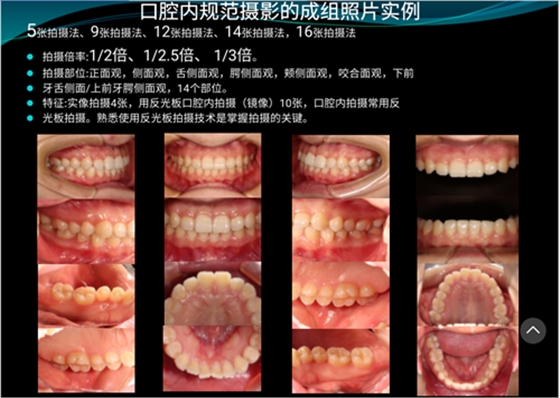 口內照攝影方法與技巧分享