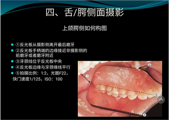 口內照攝影方法與技巧分享