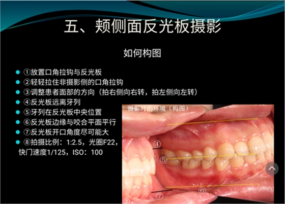 口內照攝影方法與技巧分享