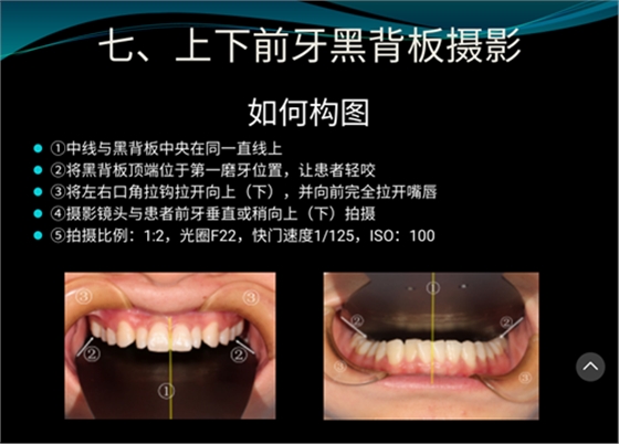 口內照攝影方法與技巧分享
