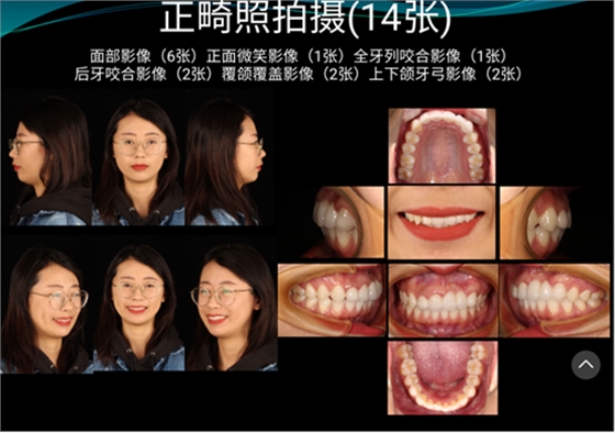 口內照攝影方法與技巧分享
