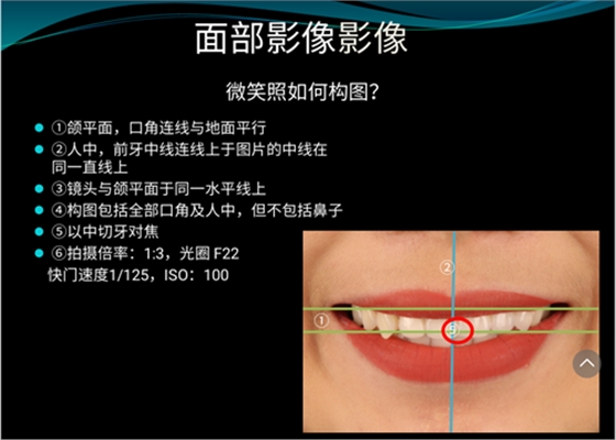 口內照攝影方法與技巧分享