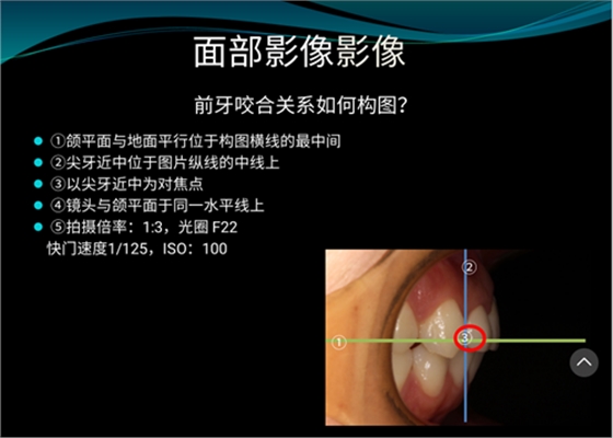 口內照攝影方法與技巧分享