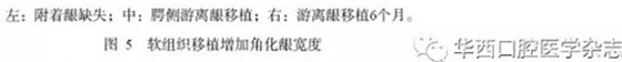 【專家共識】種植修復臨床評價標準
