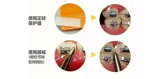 特殊時期為什么常規的口腔治療都不能做了？