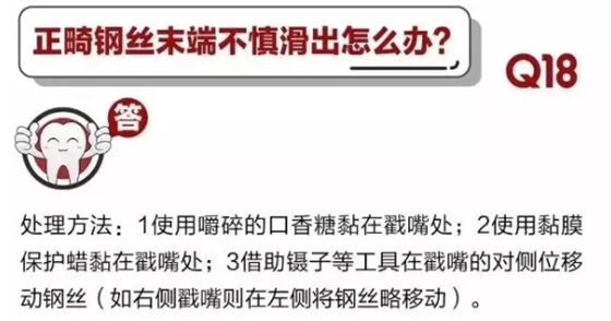 	 牙醫停診了？別怕，請您收下這份居家牙科急癥指南！