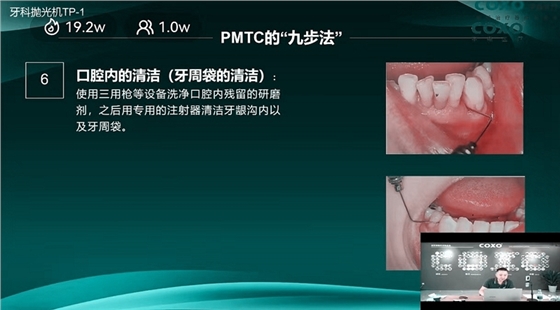 牙周袋的清潔 牙周袋的清潔