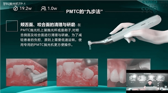 頰舌面、咬合面的清理與研磨 頰舌面、咬合面的清理與研磨