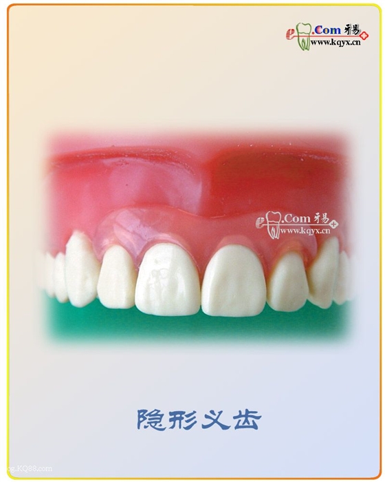 醫患溝通圖譜收集    推薦