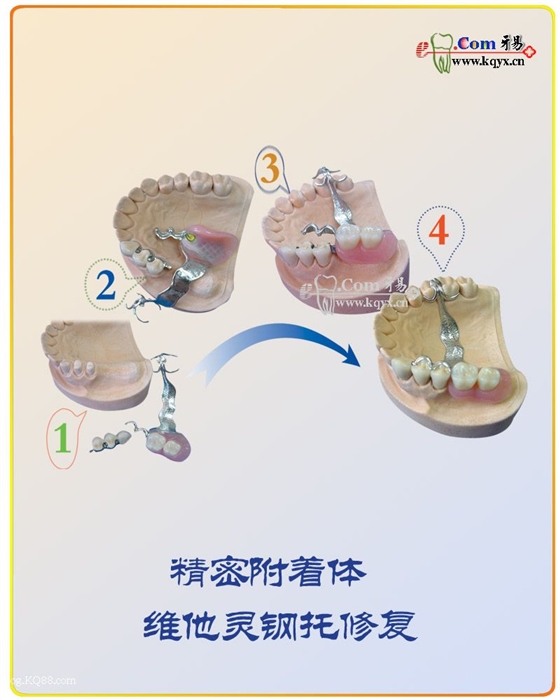醫患溝通圖譜收集    推薦