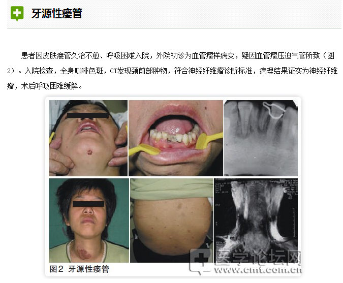 口腔疾病與全身系統性疾病的關系