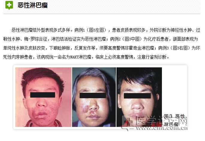 口腔疾病與全身系統性疾病的關系