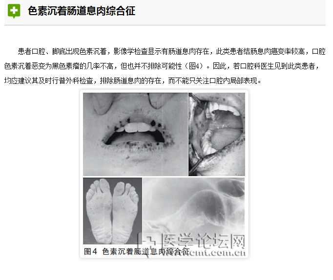 口腔疾病與全身系統性疾病的關系