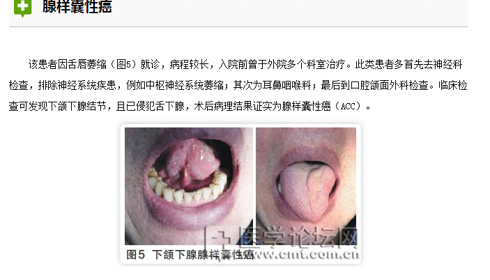 口腔疾病與全身系統性疾病的關系