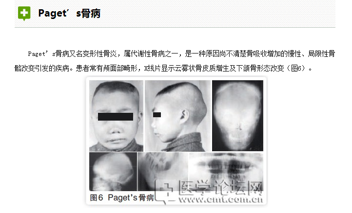 口腔疾病與全身系統性疾病的關系