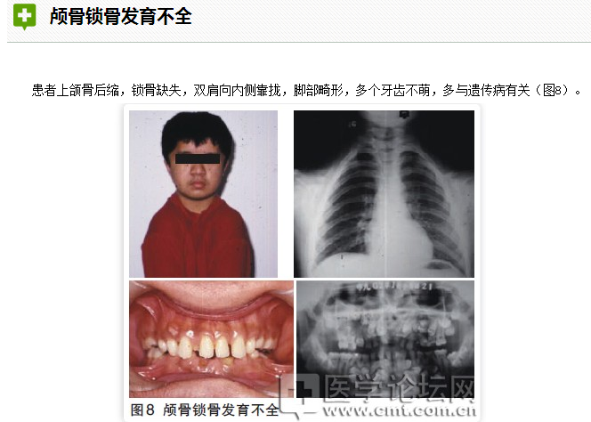 口腔疾病與全身系統性疾病的關系