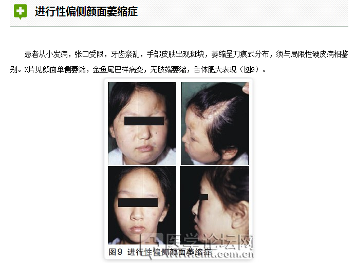 口腔疾病與全身系統性疾病的關系