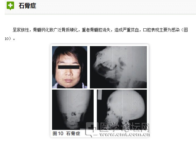 口腔疾病與全身系統性疾病的關系