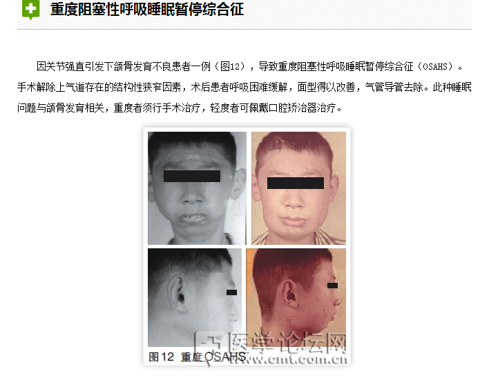 口腔疾病與全身系統性疾病的關系