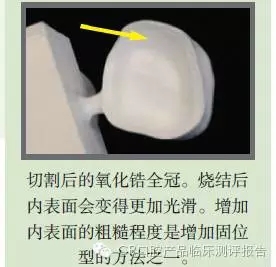 CR權(quán)威發(fā)布：如何克服氧化鋯粘固時的問題