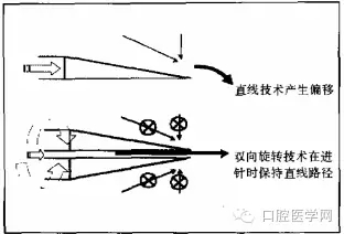 即使是老手也會(huì)失手的麻醉----下牙槽、舌、頰一次阻滯麻醉