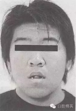 口腔醫學主治醫師筆試-精講強化-齲病牙體硬組織牙髓病和根尖周