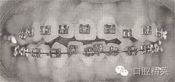 口腔醫學主治醫師筆試-精講強化-齲病牙體硬組織牙髓病和根尖周
